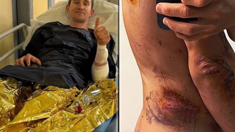 El doloroso regreso de Michal Kwiatkowski tras su impactante caída en San Remo