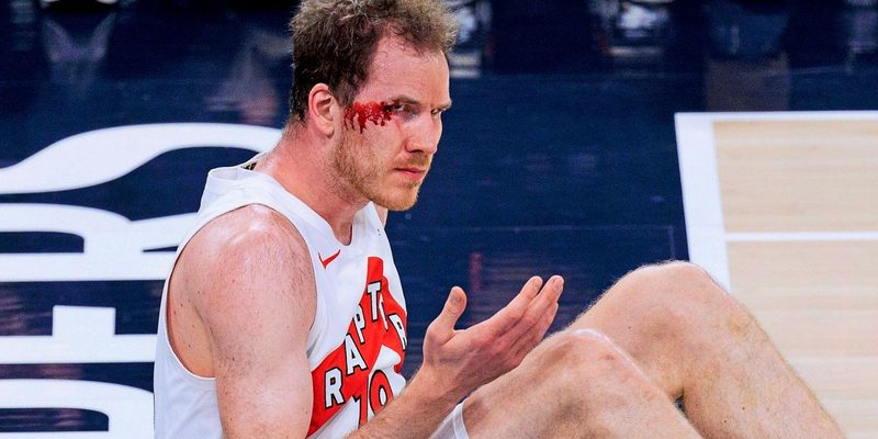 Toronto Raptors scheitern deutlich gegen LA Clippers und verlieren Pöltl durch Verletzung