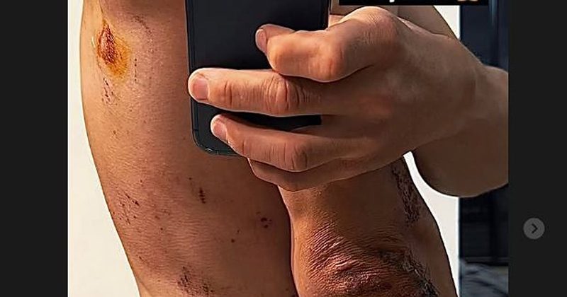 La caída de Kwiatkowski en la Milán-San Remo deja imágenes impactantes