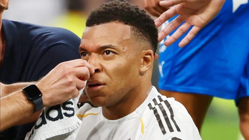 La polémica del penalti a Mbappé: árbitros del VAR no vieron la hemorragia