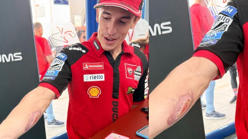 Marc Márquez muestra su recuperación tras la lesión en Texas antes del GP de España