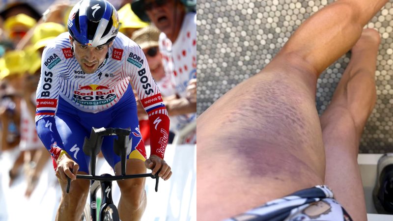 Roglič confirma su participación en LaVuelta tras el atropello que alteró su preparación
